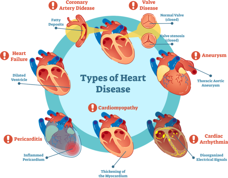 UDMI_Cardiovascular-Disease